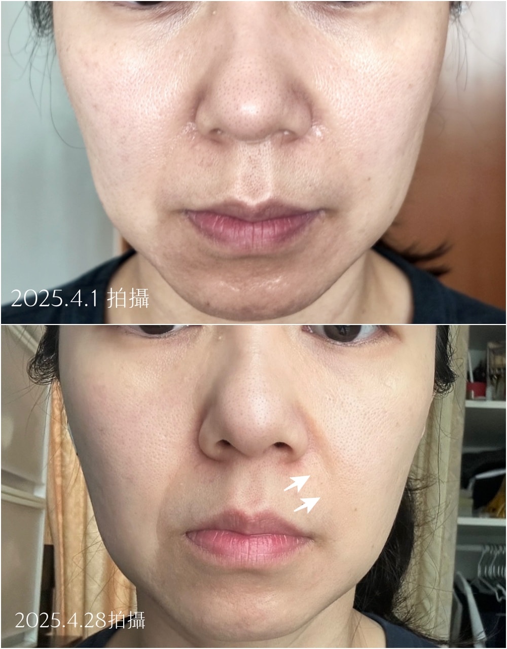 ZIIP Halo 美容儀分享、使用感及半臉測試 - 第6張圖 ZIIP Halo 美容儀分享、使用感及半臉測試